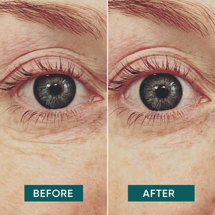 Actual product image Apricot Eye Pads Hyaluron