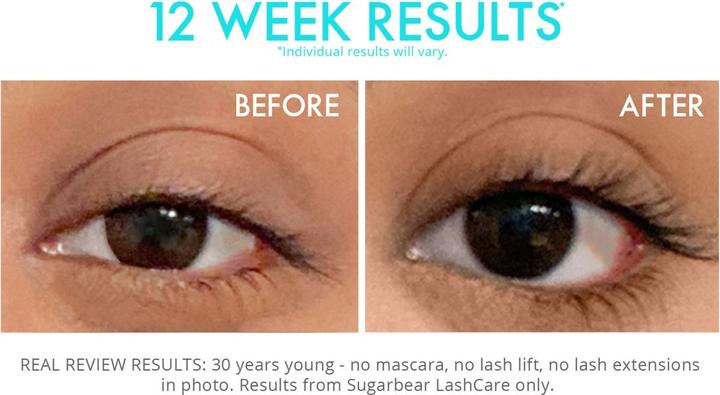 Actual product image Sugarbearhair - Lashcare Vitamin Serum (3 ml)