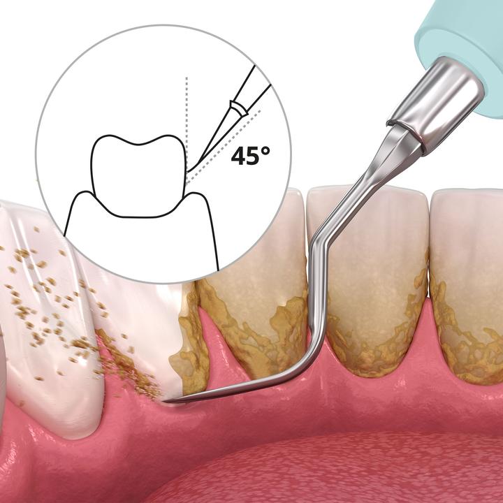 Immagine prodotto Ailoria Deplaqued (Pulitore sonico per denti)