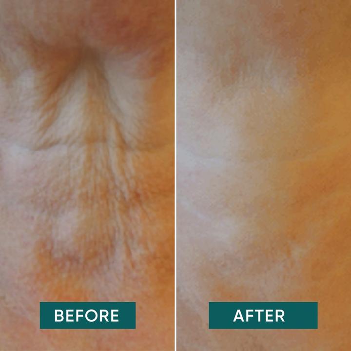 Actual product image Apricot - Wiederverwendbares Nackenkissen Mit Hyaluron It's Neck Or Nothing - 1 Stk.