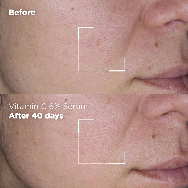 Actual product image Skin Republic Vitamin C 6% (30 ml)
