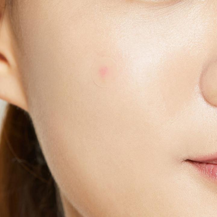 Produktbild Cosrx Acne Pimple Master