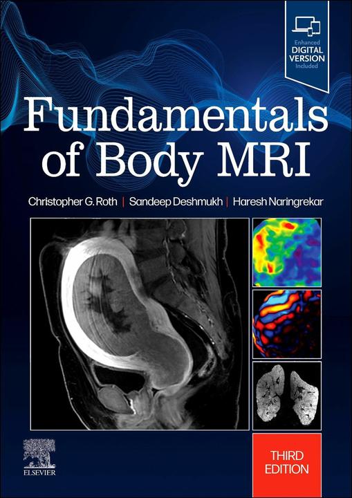 Fundamentals of Body MRI (English, Haresh Naringrekar, Deshmukh Sandeep, Roth Christopher G., 2024)