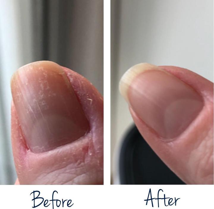 Actual product image Herome Exit Damaged Nails (7 ml)