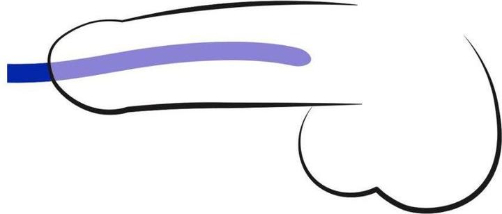 Immagine prodotto You2Toys Set di dilatatori