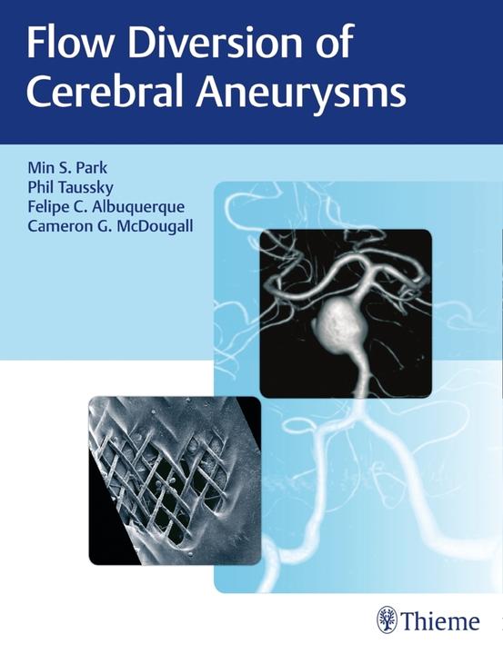 Immagine prodotto Flow Diversion of Cerebral Aneurysms (Inglese, Cameron G. McDougall, Felipe C. Albuquerque, Philipp Taussky, Min S. Park, 2017)