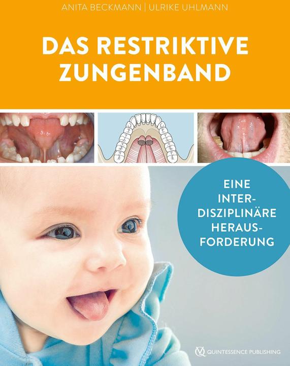 Produktbild Das restriktive Zungenband (Deutsch, Anita Beckmann, Ulrike Uhlmann, 2024)
