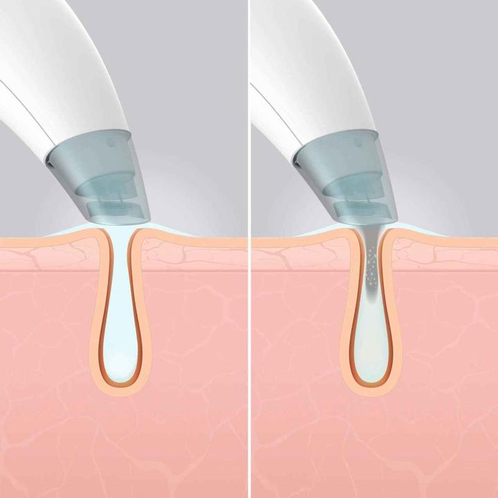 Immagine prodotto Homedics Hydrafacial Cleanser