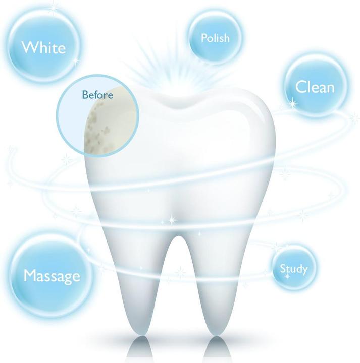Actual product image Silk'n Sonic Smile (Sonic toothbrush)