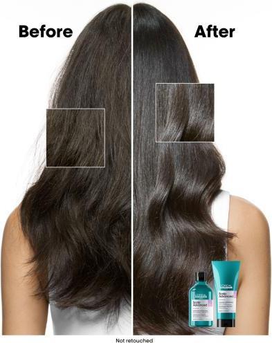 Produktbild L'Oréal Professionnel Serie Expert Scalp Advanced Anti-Discomfort Dermo-Regulator Refill (500 ml, Flüssiges Shampoo)