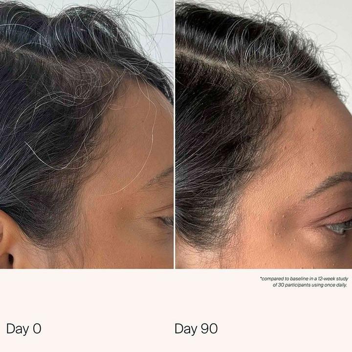 Actual product image Living Proof Scalp Care Density Serum 1.7 Fl Oz (50 ml)