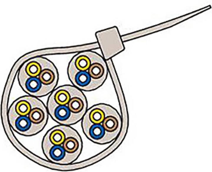 Produktbild Fischer Trockenbau-Dübel-Set (Metallkabelbinder, 250 mm, 100 Stk.)