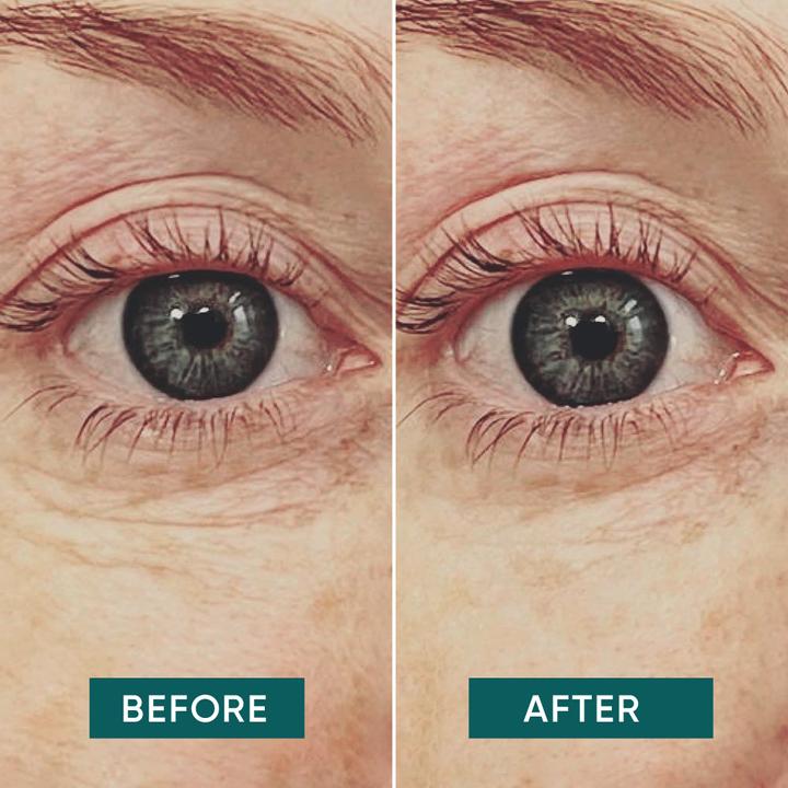 Produktbild Apricot wiederv. Twice as Nice - Duo "me, myself & eye" Augen Pads (Patches)