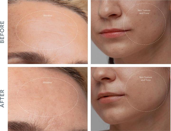 Actual product image Foreo Kiwi Derma