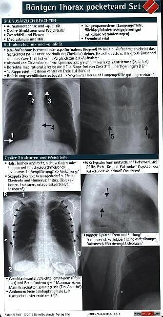 Image du produit Röntgen Thorax pocketcard Set (Allemand, S. Voss, 2015)
