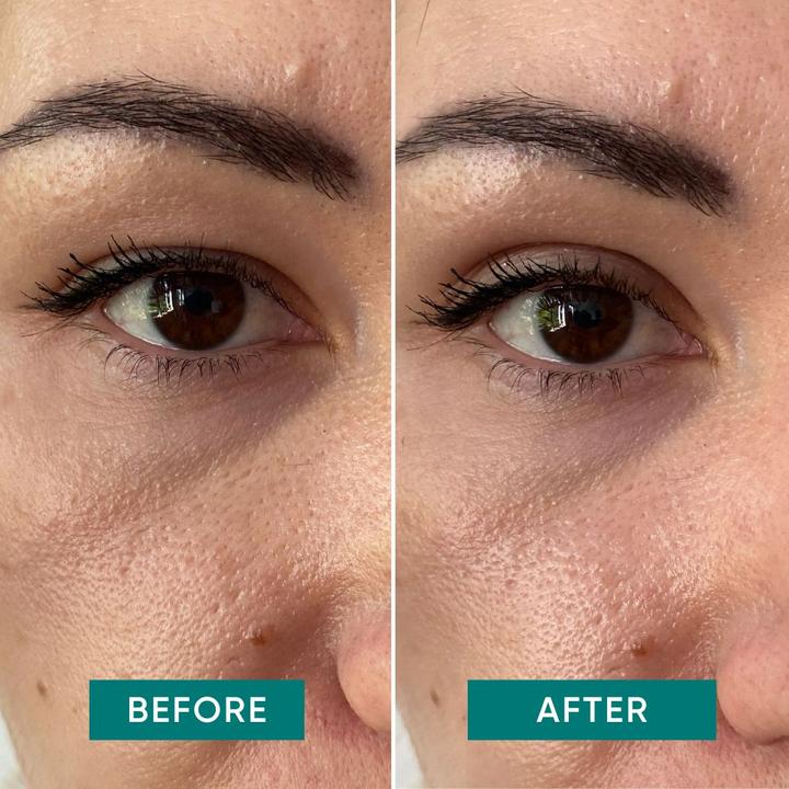 Actual product image Apricot Eyelid Tapes - bye sleepy eye (Patches)