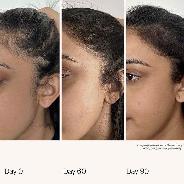 Actual product image Living Proof Scalp Care Density Serum 1.7 Fl Oz (50 ml)