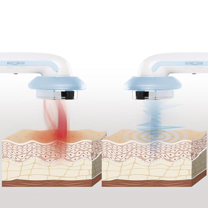 Immagine prodotto InnovaGoods Dispositivo di massaggio con cavitazione a ultrasuoni