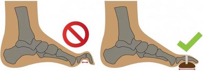 Produktbild Bota Podo 37 Rechts (One Size)