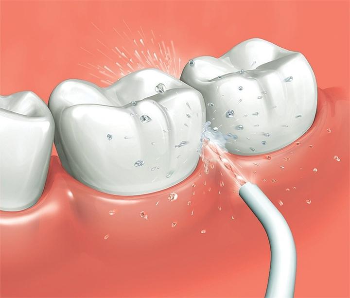 Actual product image Panasonic Ew0955 (Oral irrigator attachments)