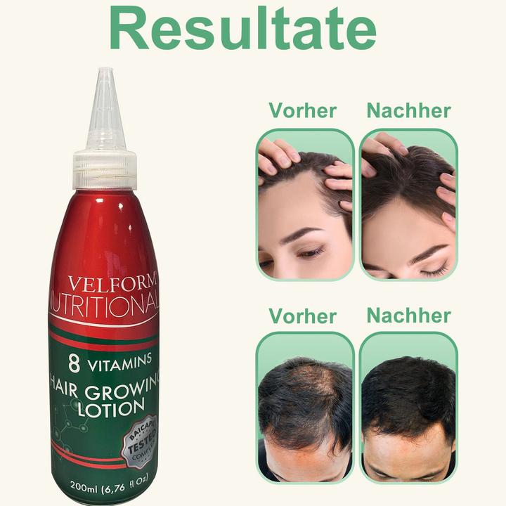 Actual product image Velform Nutritional Nutritional (200 ml)