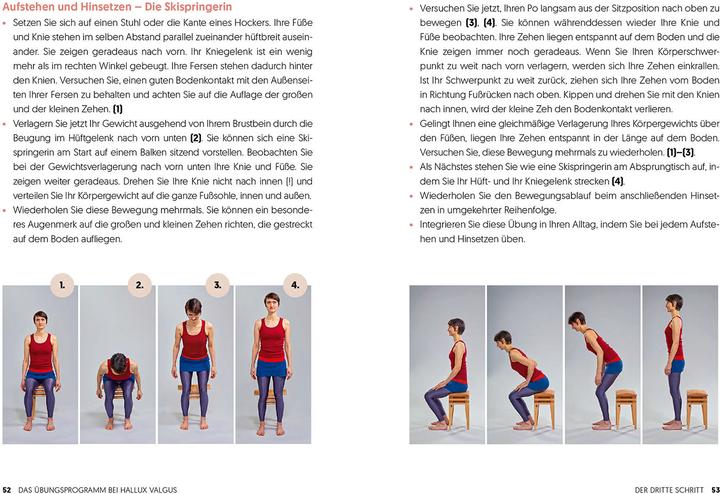 Actual product image Hallux Valgus - Nachhaltige Hilfe ohne OP (German, Rogall, Thomas, 2024)