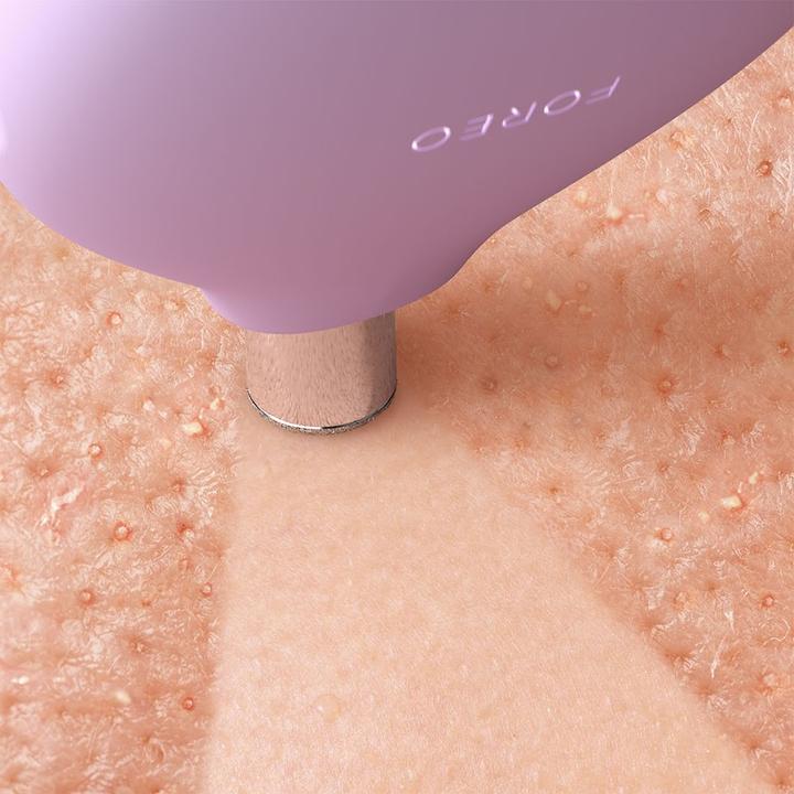 Actual product image Foreo Kiwi Derma