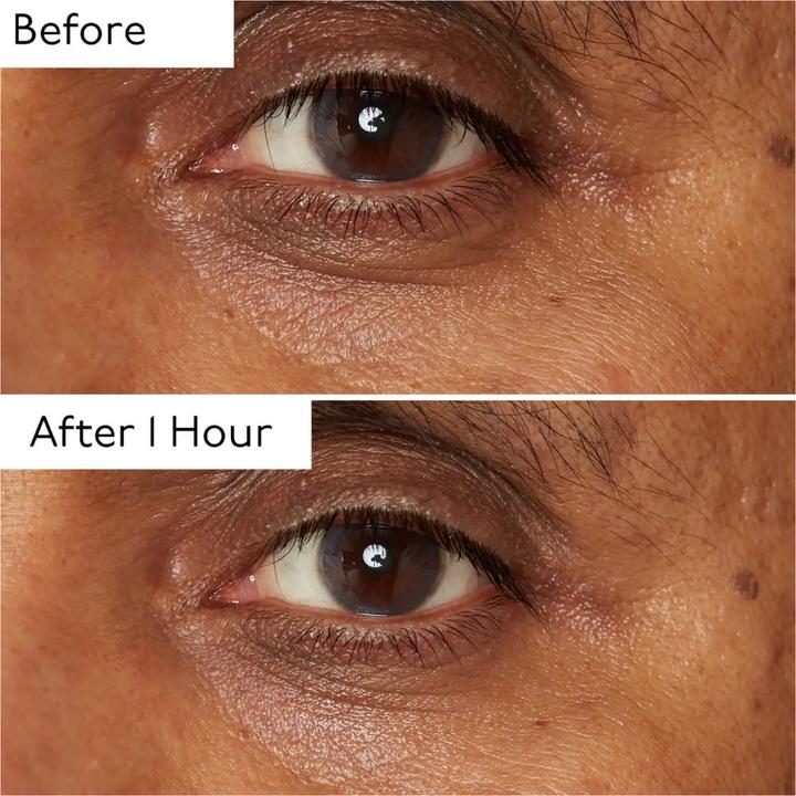 Produktbild By Terry Hyaluronic Global Eye Serum (Serum, 15 ml)