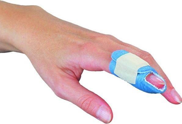 Image du produit Chrisofix attelle de doigt maillet IPD (L)