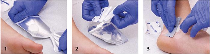 Image du produit IVF Hartmann plus Cavity Coussinet (2112.26 ml)