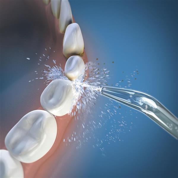 Produktbild Waterpik Whitening Classic (Mundduschenaufsätze)