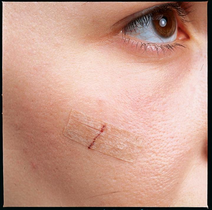 Actual product image Nexcare Steri-Strip wound closure strips (6 x)