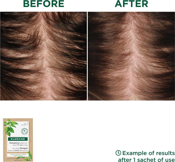Produktbild Klorane Maske Shampoo-Puder mit BIO-Brennnessel (24 ml, Flüssiges Shampoo)