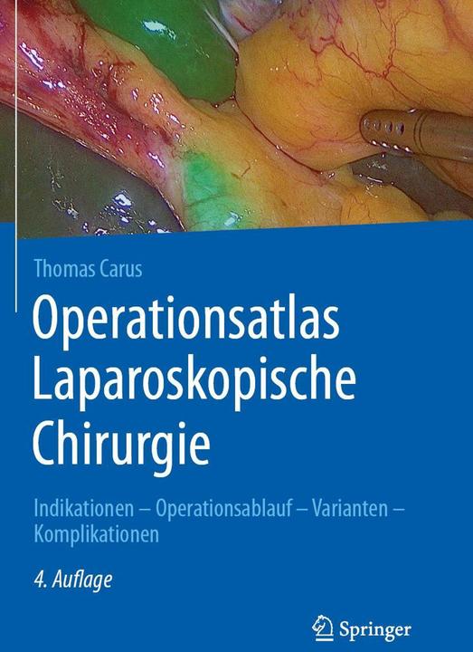 Image du produit Operationsatlas Laparoskopische Chirurgie (Allemand, Thomas Carus, 2024)