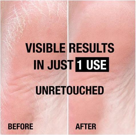 Immagine prodotto Neutrogena Ricca crema per i piedi (Crema piedi e gel piedi, 100 ml)