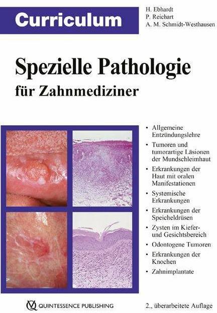 Actual product image Curriculum Spezielle Pathologie für Zahnmediziner (German, Harald Ebhardt, Peter A. Reichart, Andrea Maria Schmidt-Westhausen, 2018)