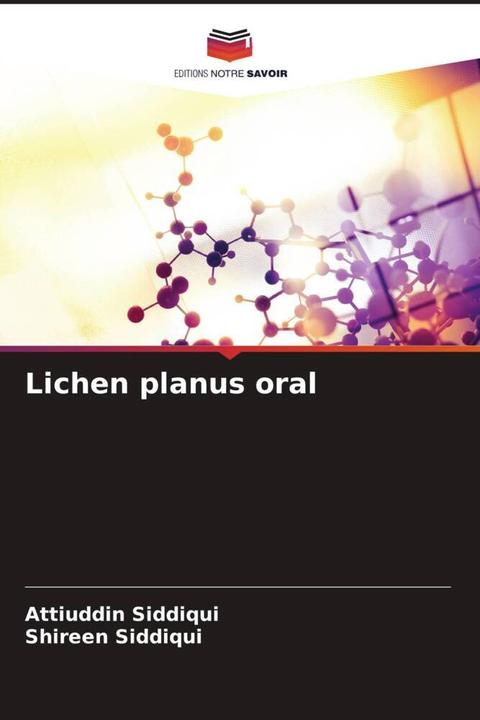 Actual product image Lichen planus oral (Attiuddin Siddiqui, Shireen Siddiqui, 2022)