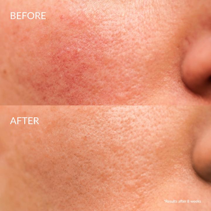 Produktbild Iren Shizen Serum Keep calm (20 ml)