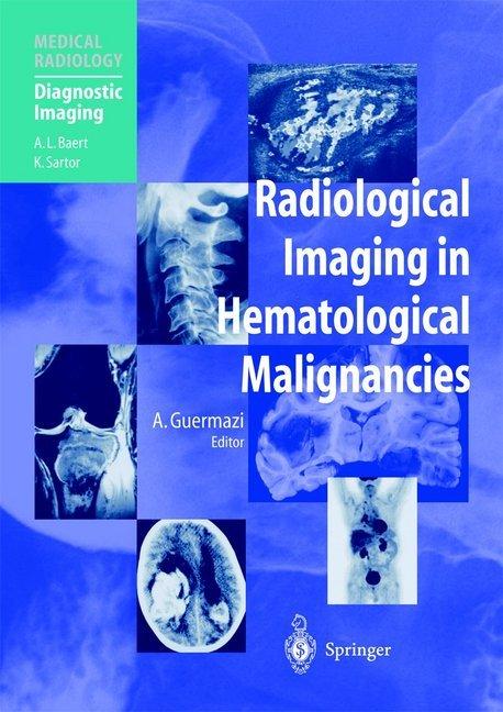Actual product image Radiological Imaging in Hematological Malignancies (Ali Guermazi, 2012)