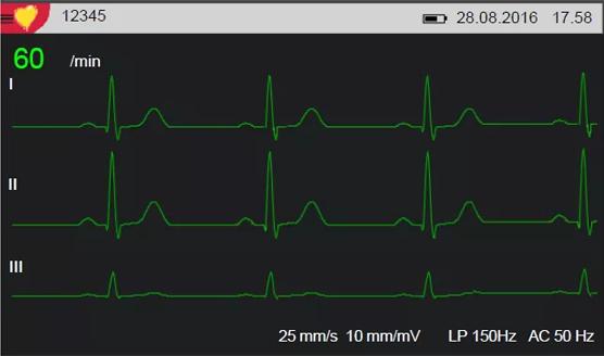 Actual product image Resting ECG Cardiovit AT-1 G2 with interpretation option
