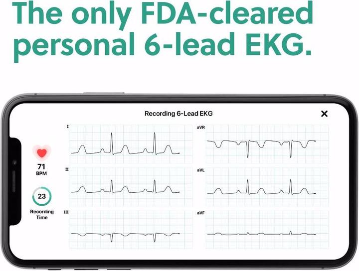 Produktbild AliveCor Kardiamobile 6L