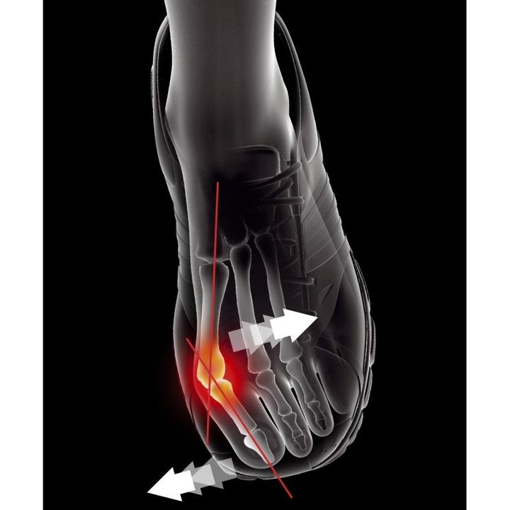 Produktbild Epitact fussschutz hallux valgus (M)