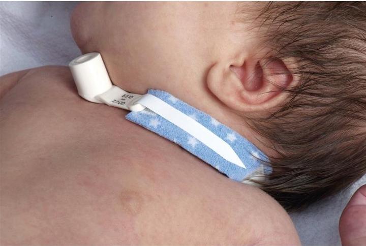 Produktbild Dale Tracheostomy Tube Holder Kleinkinder 242