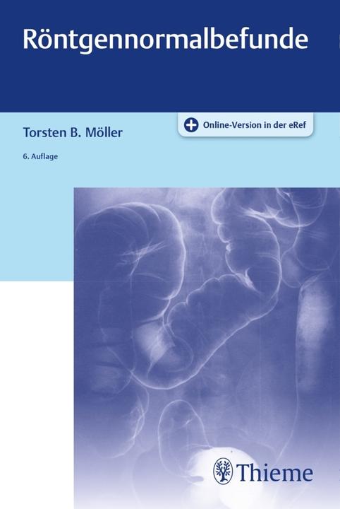Produktbild Röntgennormalbefunde (Deutsch, Torsten B. Möller, 2019)
