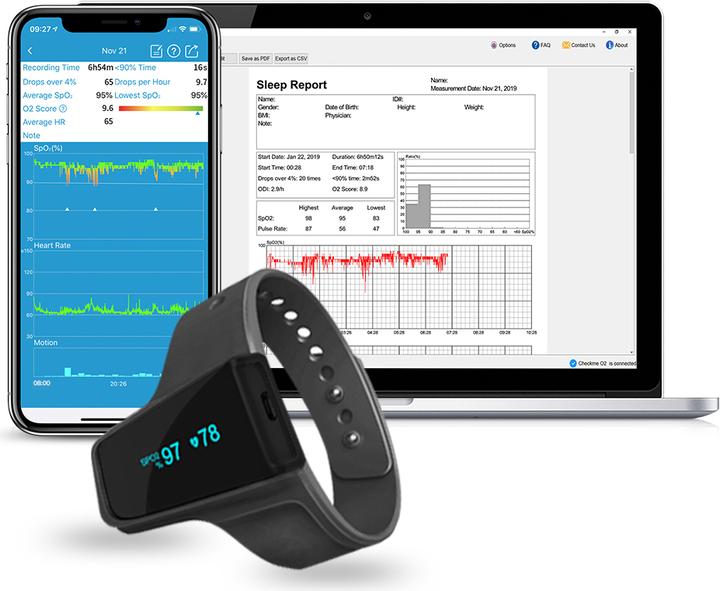 Actual product image ViatomTech Checkme O2 Max