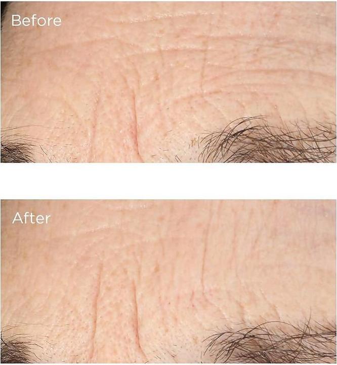 Actual product image Perricone MD Essential Fx Acyl-Glutathione: Deep Crease Facial Serum 30 ml Women Rose (30 ml)