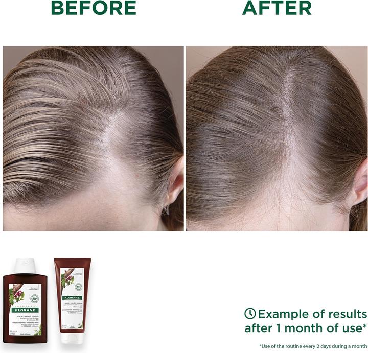 Produktbild Klorane Pflegebalsam mit Chinin und BIO-Edelweiss (50 ml)