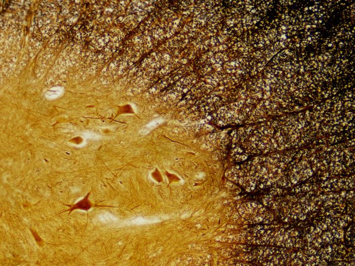 Actual product image Bresser Permanent preparations: Histology