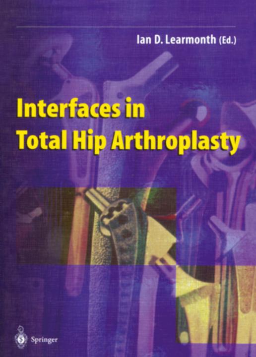 Produktbild Interfaces in Total Hip Arthroplasty (Ian D. Learmonth, 2012)