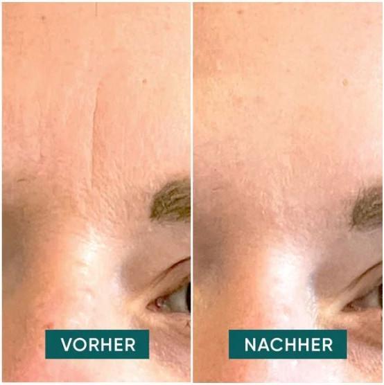 Image du produit Apricot Patches visage anti-rides Hyaluron (96 ml)